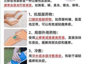 为什么翁止熄痒婉燕能够有效缓解瘙痒？