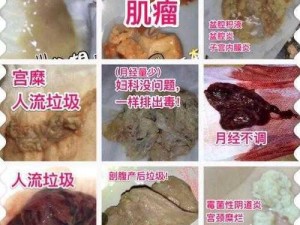 老中医用嘴排阴毒？排出毒素一身轻松