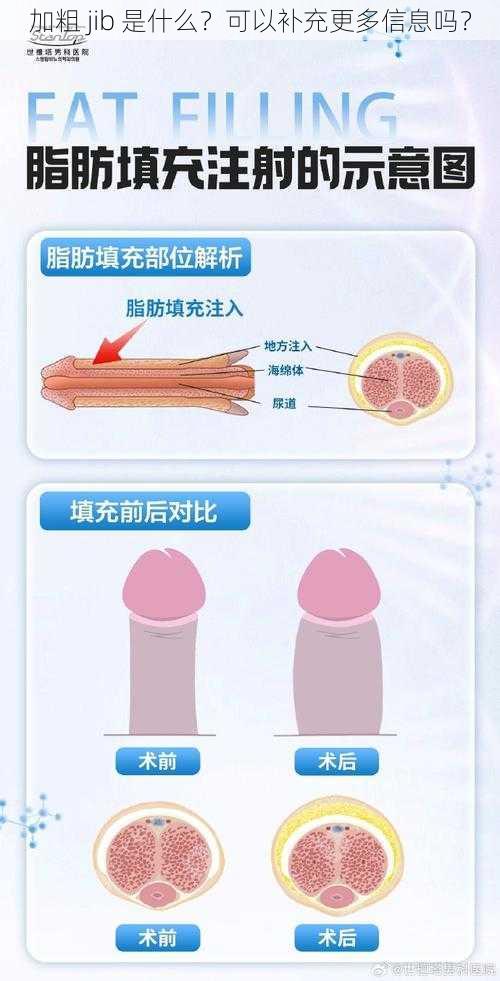 加粗 jib 是什么？可以补充更多信息吗？